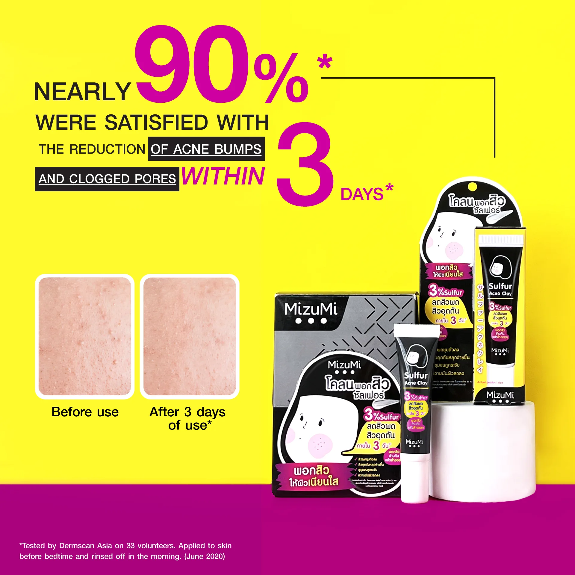 MizuMi Sulfur Acne Clay